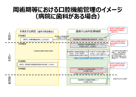 周術期等における口腔機能管理のイメージ（病院に歯科がある場合）